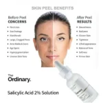 سرم ضد جوش اوردینری نیاسینامید 10درصد + زینک 1درصد ordinary - Image 2